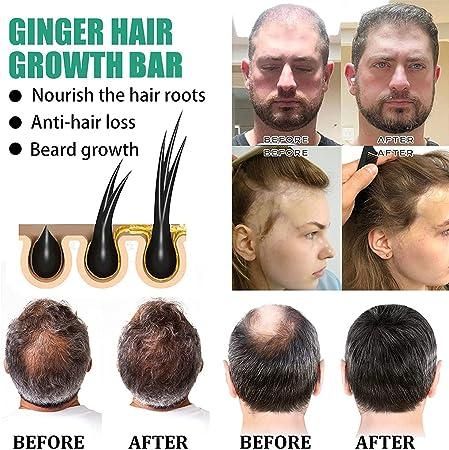 Ginger Hair Growth Bar (Pack of 1)